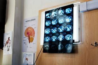 “11 anni di chemio per un tumore che non c’era”, la diagnosi sbagliata e l’incubo