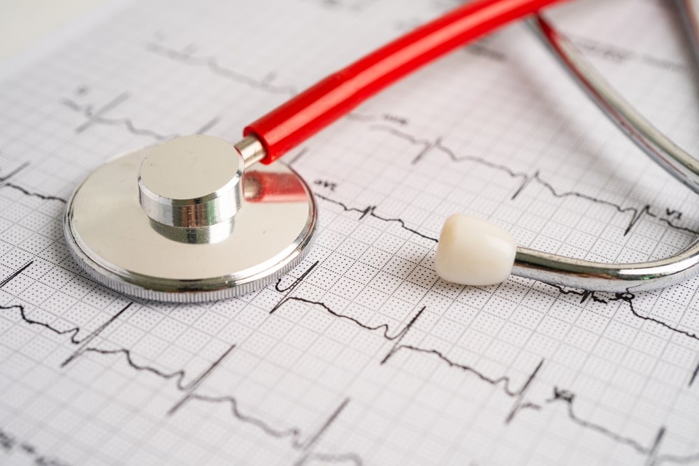 Le malattie cardiovascolari sono la prima causa di morte nel mondo. Solo in Italia il 35% dei decessi annui è imputabile ad esse.