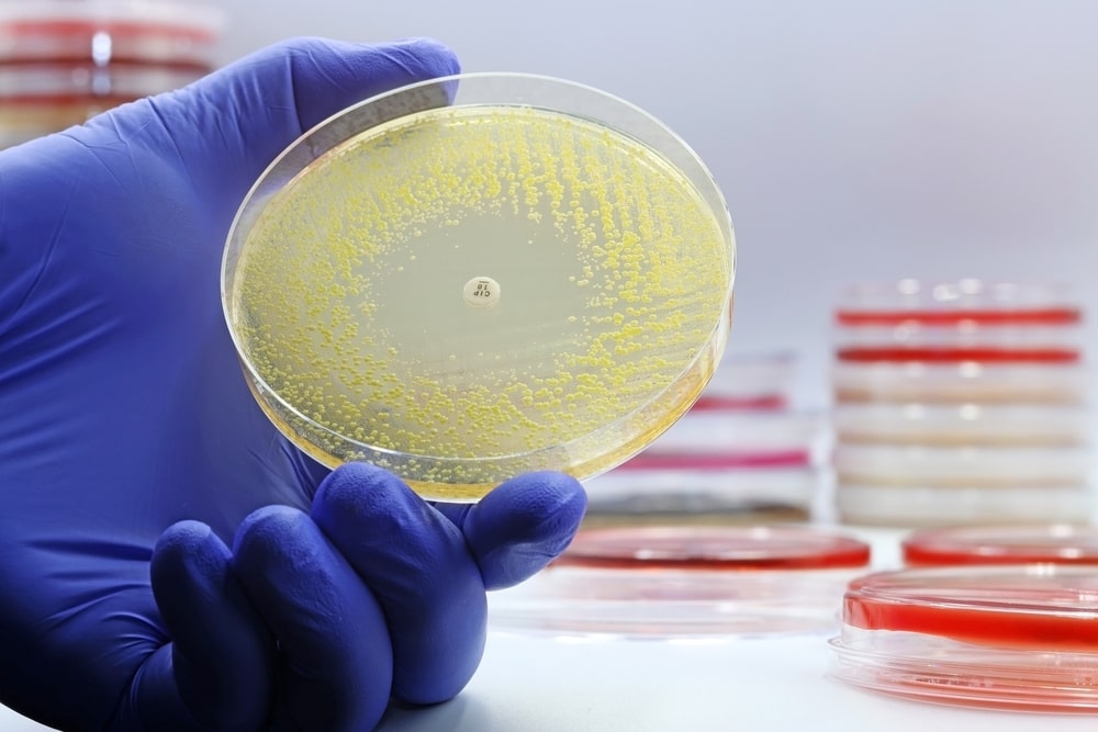 Antibiotico-resistenza la strategia dell’Italia