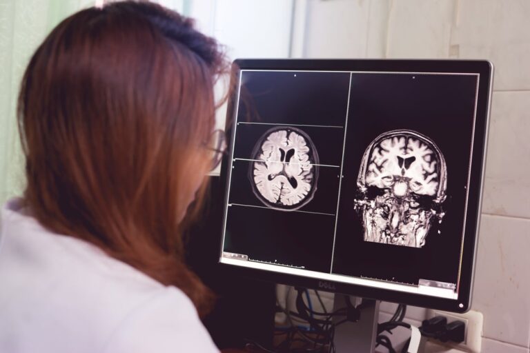 Demenze, la ricerca dell’Iss sui Centri per i disturbi cognitivi