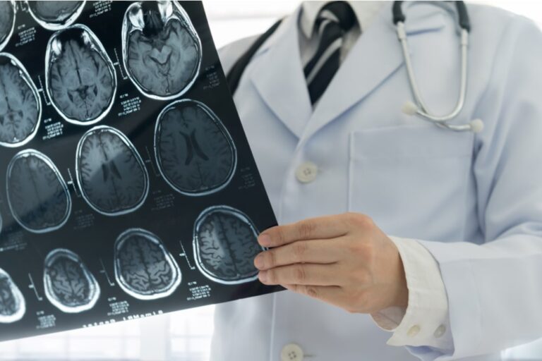 Ictus cerebrale: ogni minuto è prezioso. L’intervista a Danilo Toni