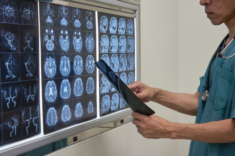 Sclerosi multipla, in Italia un paziente su dieci è senza cure adeguate