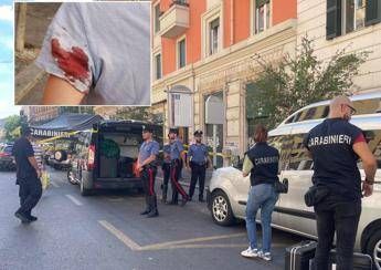 Spari a Roma, donna ferita a Prati: l’arma potrebbe essere un fucile, colpi da dieci metri con pallini metallici