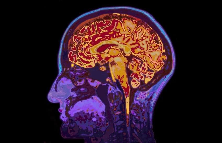 Udine. Convegno il 6 aprile sulla salute del cervello