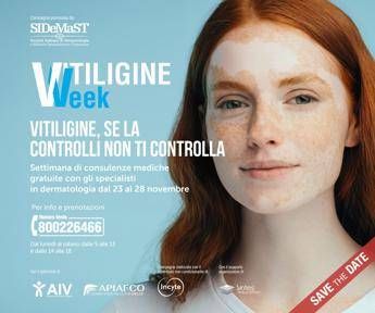 Vitiligine week, Sidemast: “Circa mille consulenze dermatologiche gratuite”