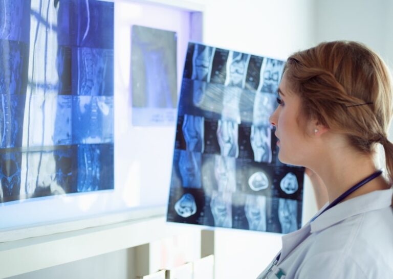 Camminare dopo una lesione midollare: lo studio sulla stimolazione cerebrale