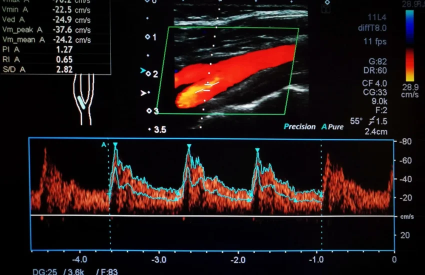 Polso venoso giugulare: un nuovo indicatore precoce dell’invecchiamento